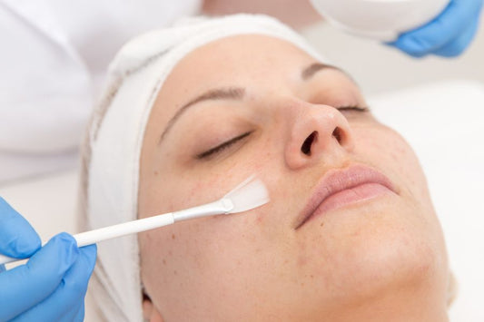 Can I Use a Chemical Peel on top of a Dermaplaning Treatment? - DermaplaningSupplies.com